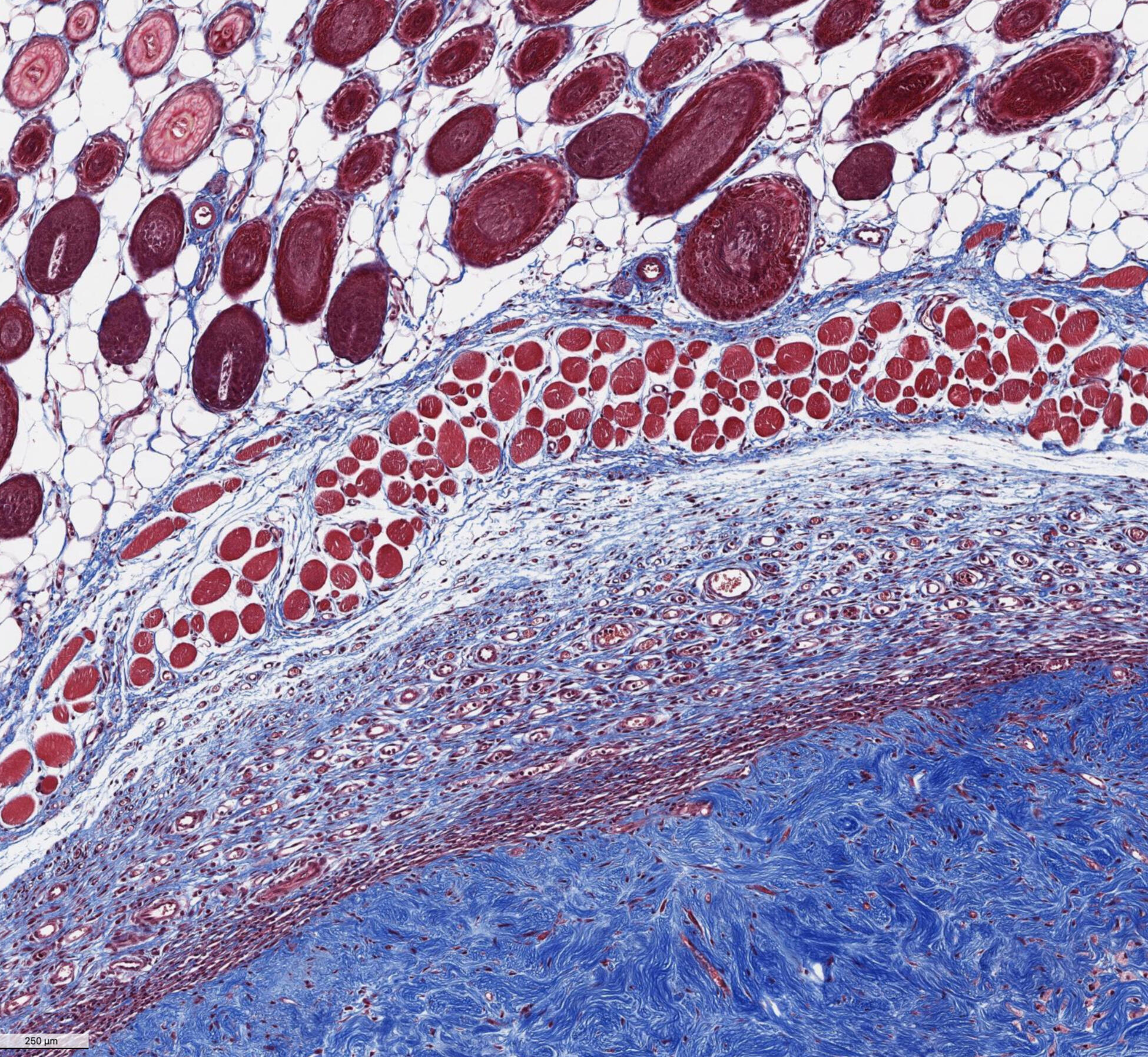 Histology of tissue using Trichrome Staining